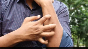A Man Started Scratching Strangers For Money. Now He Makes Rs 14 Lakh A Month