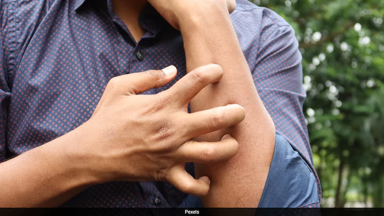 A Man Started Scratching Strangers For Money. Now He Makes Rs 14 Lakh A Month