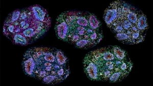 Supreme Court lens on stem cell therapy for autism