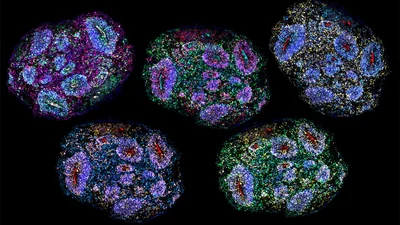 Supreme Court lens on stem cell therapy for autism