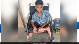 Cerebral palsy is a group of lifelong neurological disorders that permanently affect body