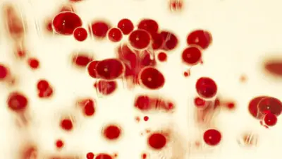 7.02 million people were found to be SCD-negative while 2.06 million were identified