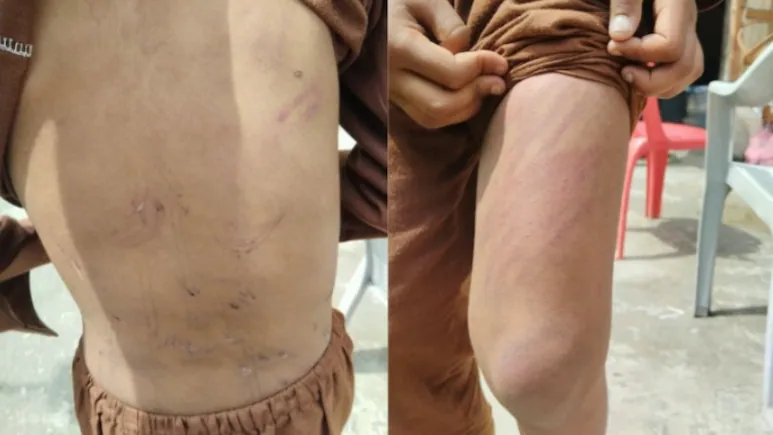 Boy, 9, Thrashed By Teacher At Jammu Madrasa, Rescued 30 Km Away: result and decisive moments