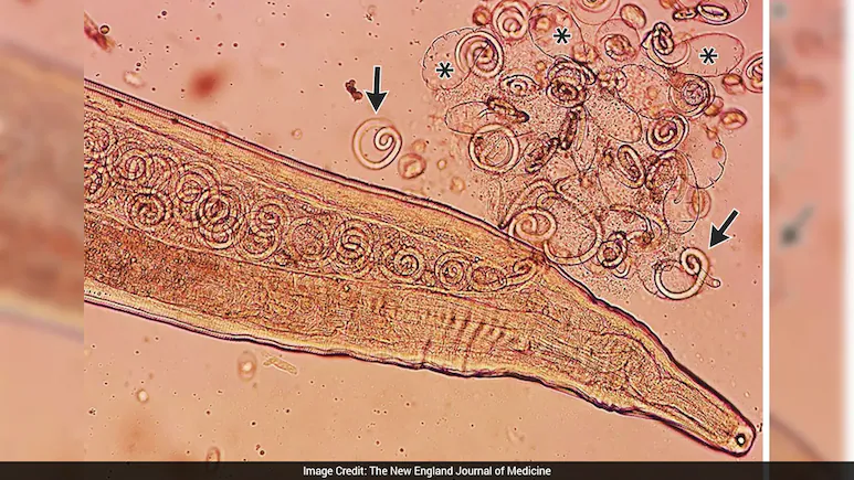 Doctors treating a 71-year-old farmer in South Korea were left surprised after discovering 11