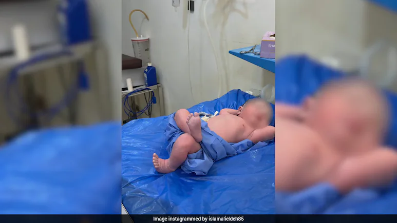 Egyptian Doctor Shares Video Of Newborn's Unusually Relaxed Pose, Amuses Internet